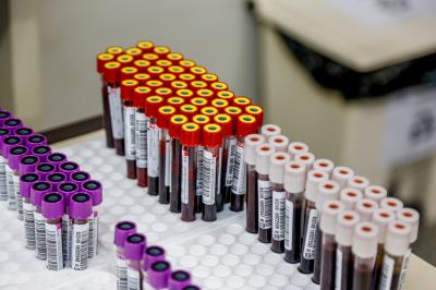 Doação de Sangue Hemopa