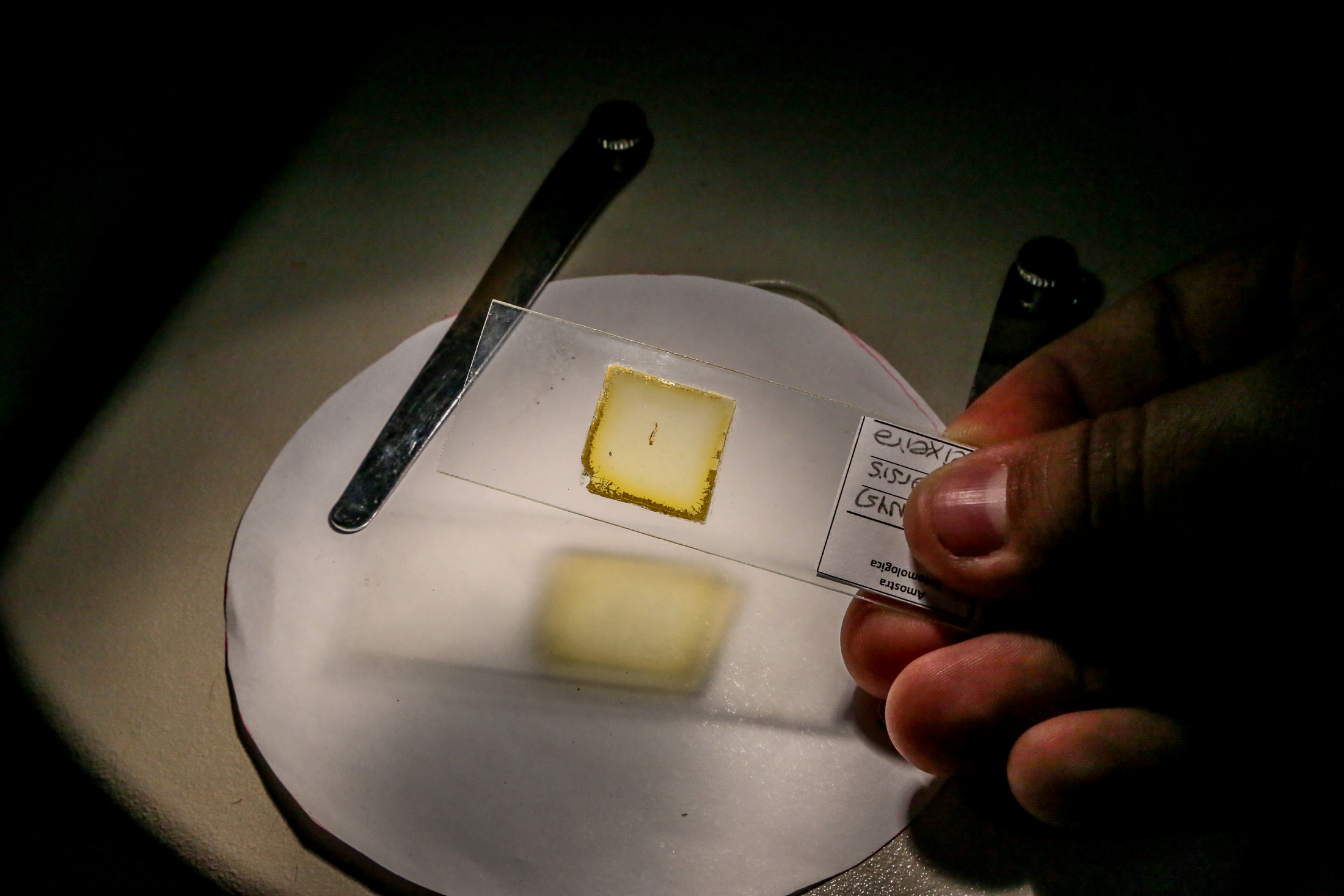 Há quatro anos não há casos de transmissão de malária em Belém	