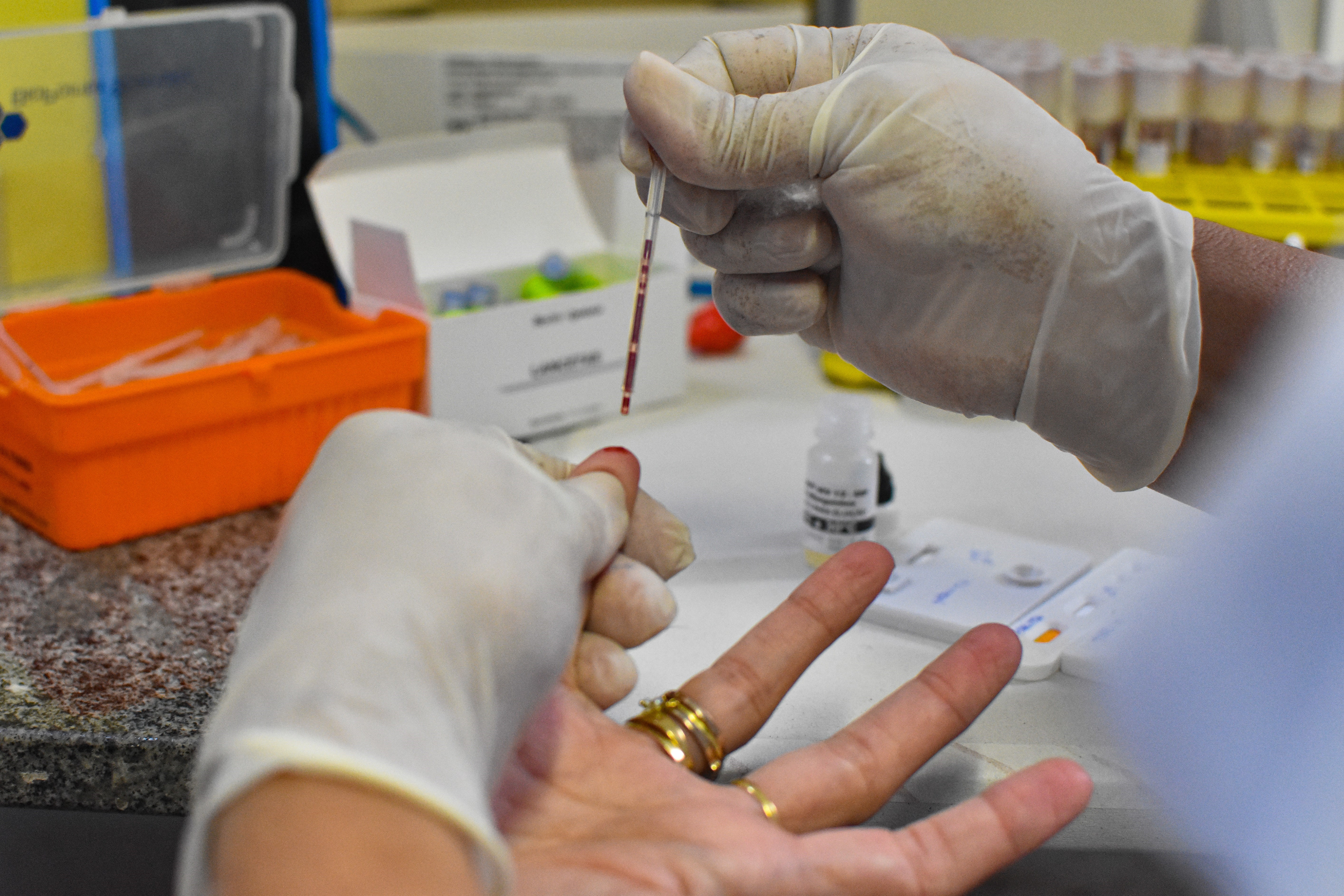 Prefeitura de Belém tem ampla atuação na prevenção e luta contra o HIV 