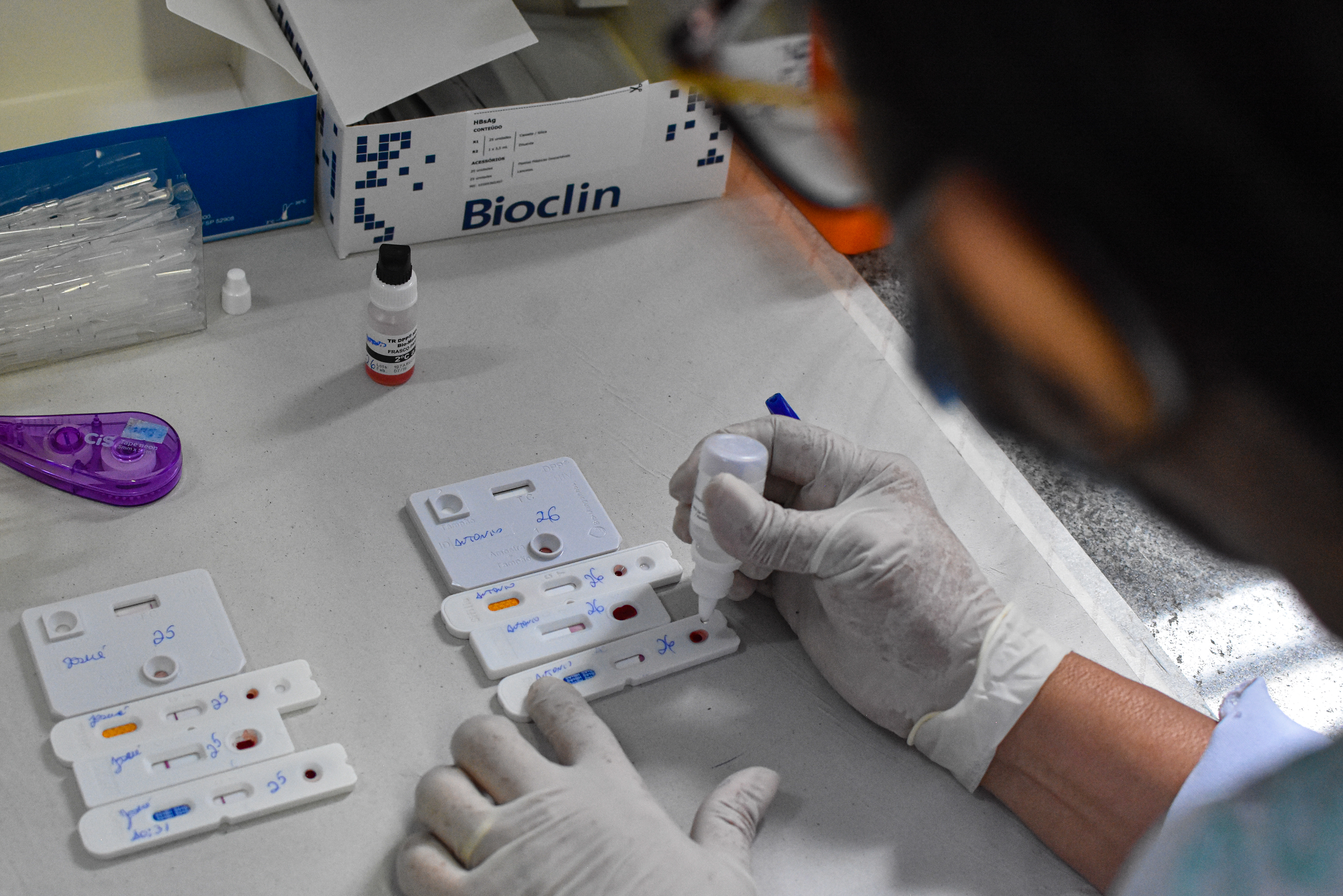 Prefeitura de Belém tem ampla atuação na prevenção e luta contra o HIV 