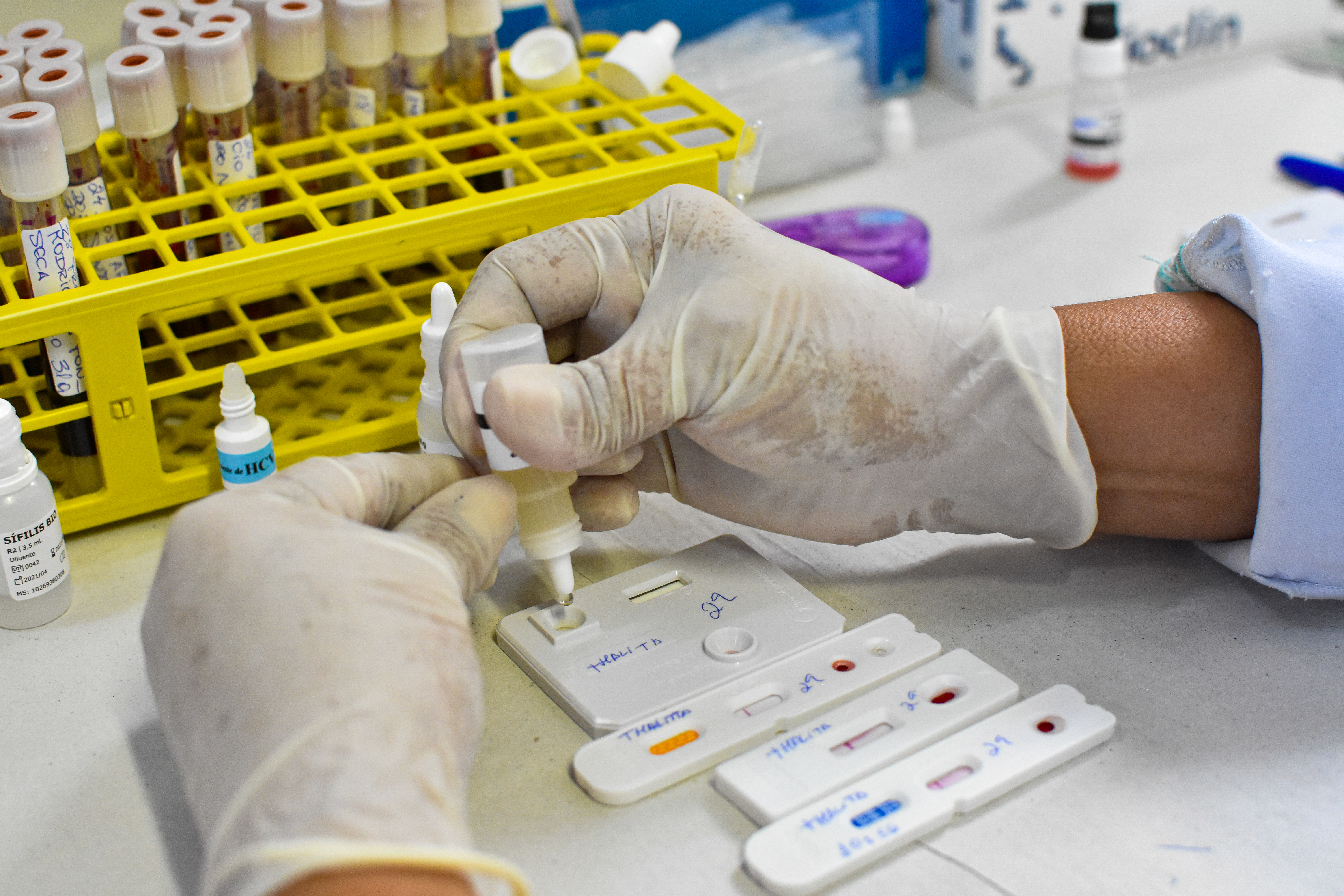 Prefeitura de Belém tem ampla atuação na prevenção e luta contra o HIV 