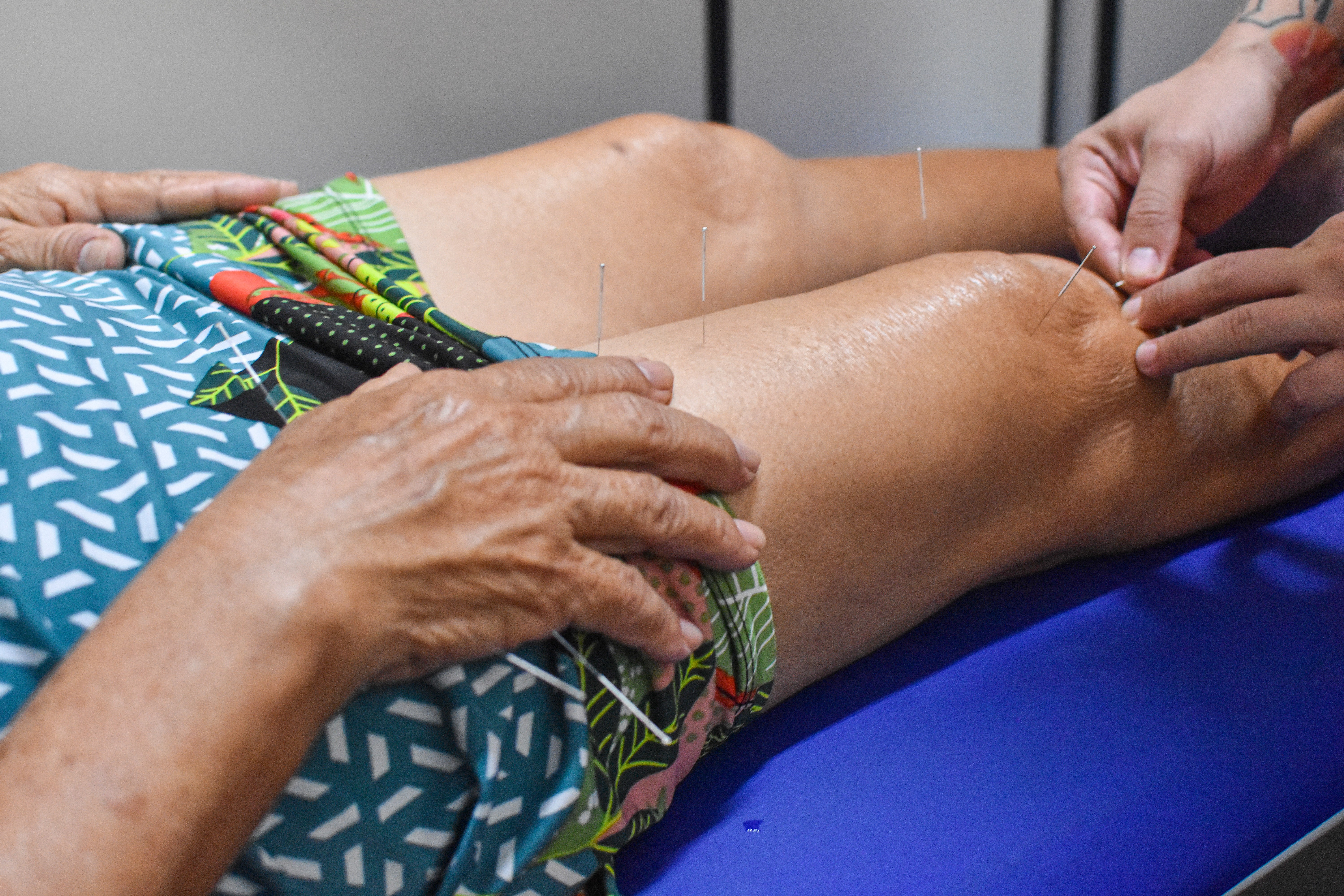 Projeto trabalha práticas que aliviam a dor e substituem uso de remédios na rede de saúde