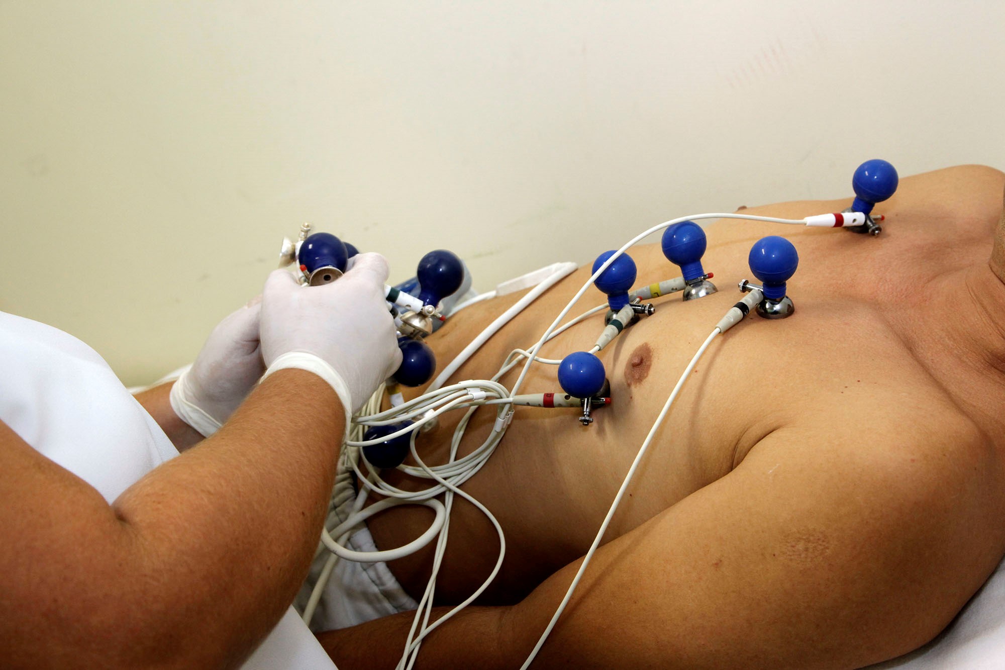 UPA de Icoaraci recebe equipamentos para a implantação do serviço de telemedicina