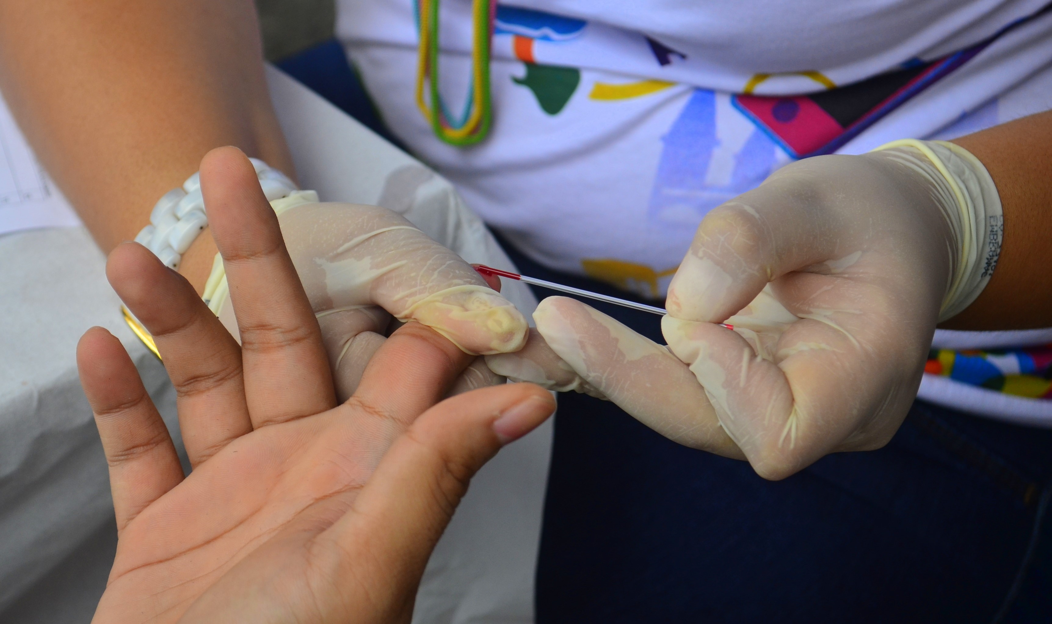 Projeto incentiva jovens e adultos a se submeterem a teste de HIV e DSTs
